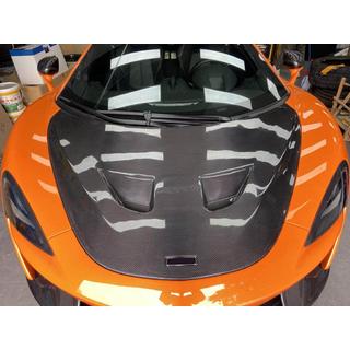 Pokrov motorja (karbon) McLaren 540C/570S 2015–2020 fotografija 2