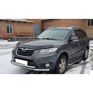 Sprednji zaščitni lok ST014 (nerjavno jeklo) fotografija 2